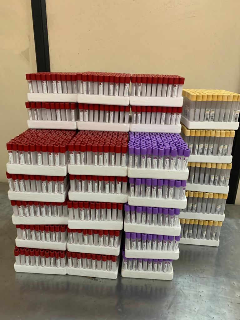 Vacuum Blood Collection Tube Manufacturers, Edta Tube, Clot Activator